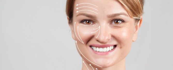 Markings on a woman's face depicting botox facial fillers