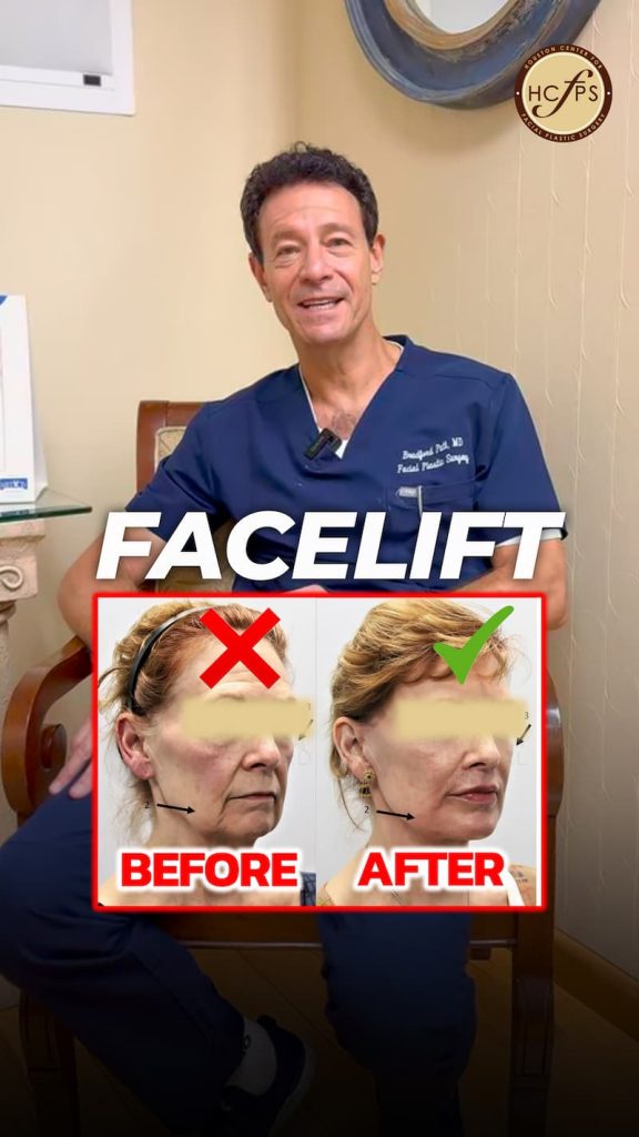 Facelift evaluations