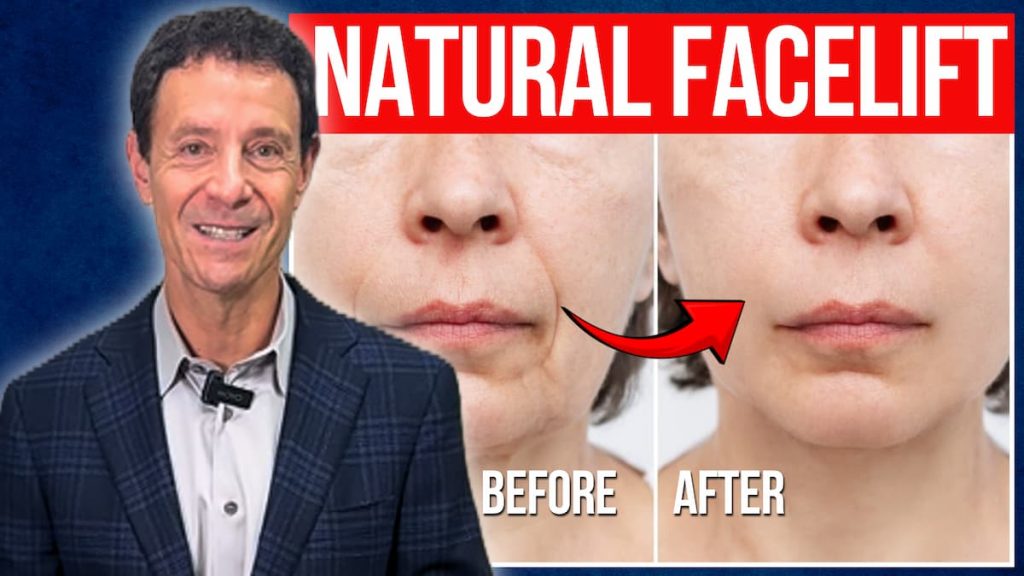 Natural Facelift: Before and After