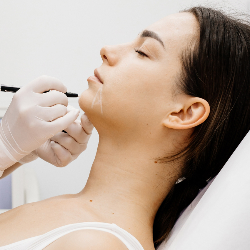 A person lies back while a gloved clinician marks the area beneath their chin with a pen.