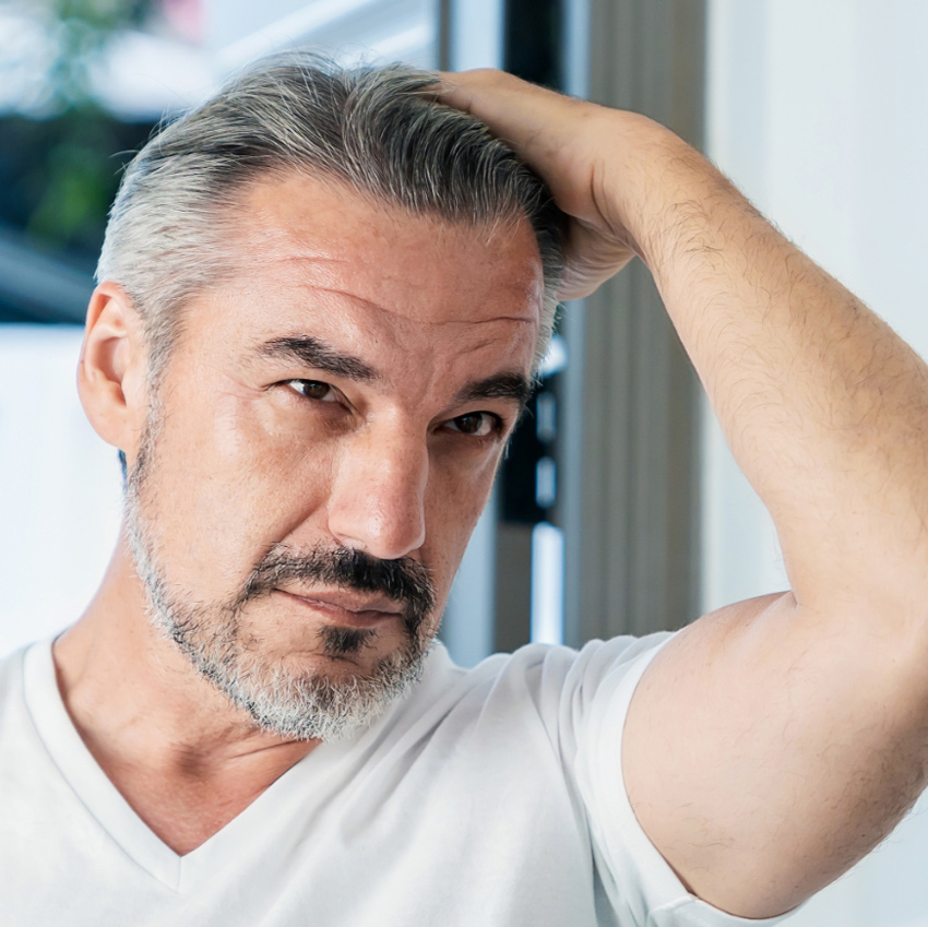A man lifts his hair with one hand while looking at his scalp in the mirror.