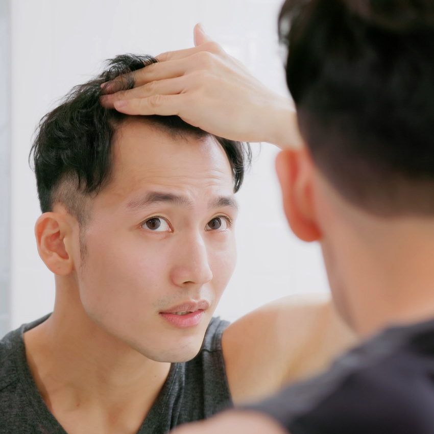 A man examines the top of his head in a mirror, lifting his hair to check his scalp.