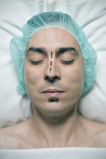 cirurgia do septo nasal desviado em houston texas