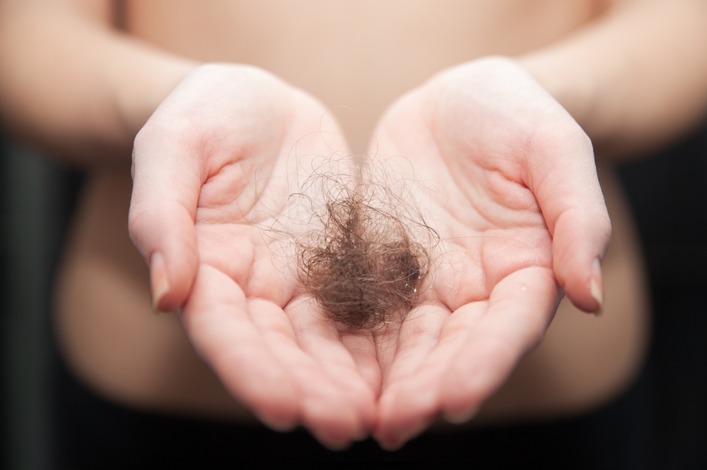 hair loss symptoms in houston