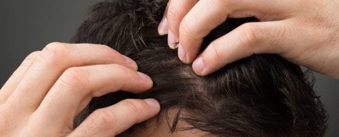 Modern Hair Restoration Options