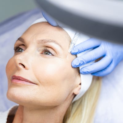 woman getting botox around eyes using botox crows feet technique