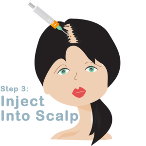 Inject Into Scalp