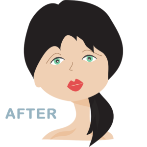 After