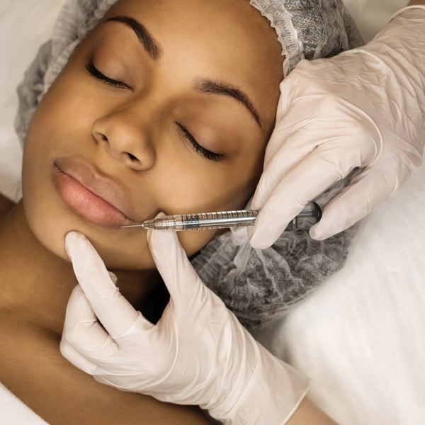 5 Major Lip Filler Benefits & What To Expect