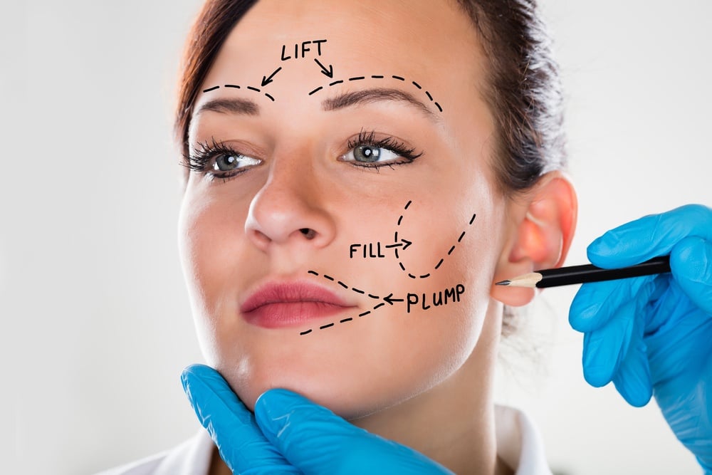 facelift surgery in houston texas