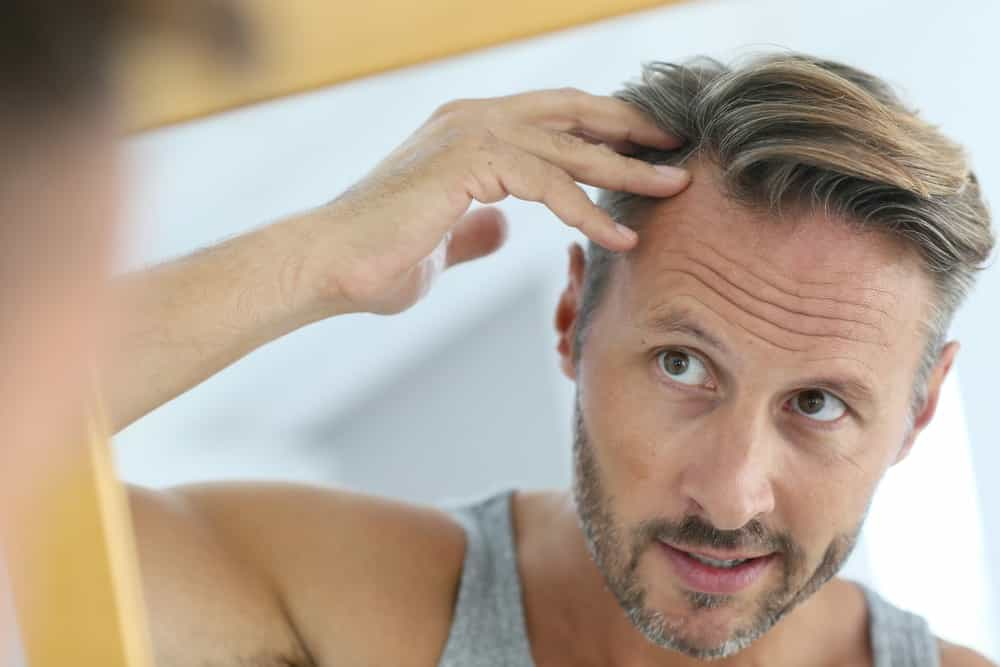 hair loss neograft procedure in houston texas