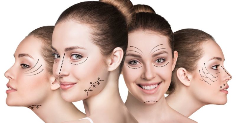 Facelift-Procedures-800x419