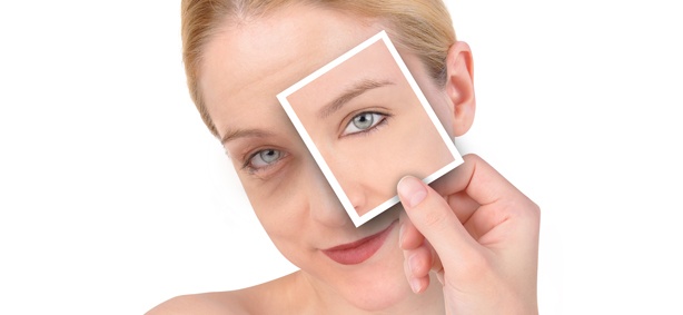 aging-skin-botox-doctors-houston