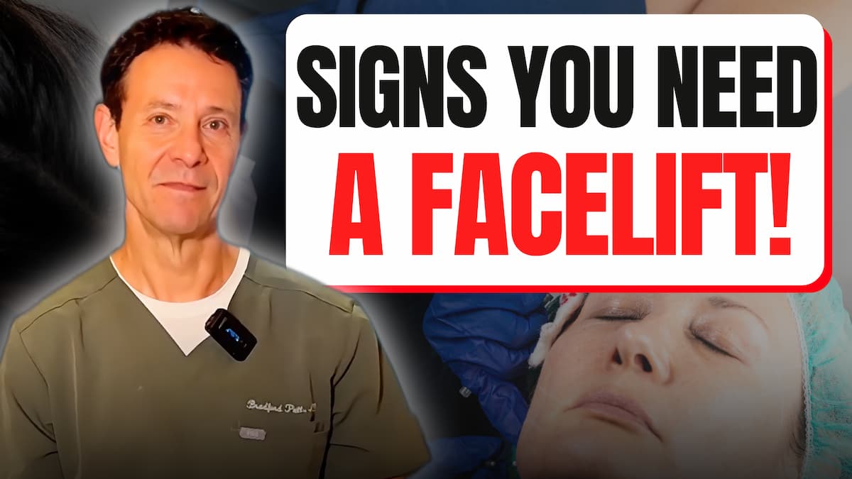 facelift