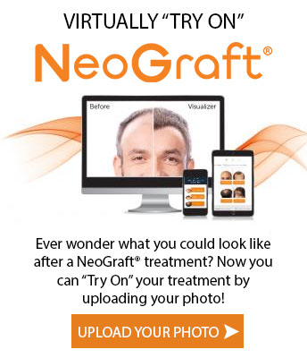 Top Reasons Why NeoGraft